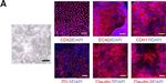 Rabbit IgG (H+L) Cross-Adsorbed Secondary Antibody in Immunocytochemistry (ICC/IF)