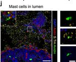 Rabbit IgG (H+L) Cross-Adsorbed Secondary Antibody in Immunohistochemistry (IHC)