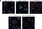 Mouse IgG (H+L) Cross-Adsorbed Secondary Antibody in Immunocytochemistry (ICC/IF)