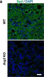 Rabbit IgG (H+L) Cross-Adsorbed Secondary Antibody in Immunocytochemistry (ICC/IF)