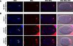 Mouse IgG (H+L) Highly Cross-Adsorbed Secondary Antibody in Immunohistochemistry (IHC)