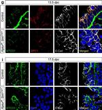 Rabbit IgG (H+L) Highly Cross-Adsorbed Secondary Antibody in Immunohistochemistry (Paraffin) (IHC (P))