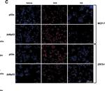 Rabbit IgG (H+L) Highly Cross-Adsorbed Secondary Antibody in Immunocytochemistry (ICC/IF)