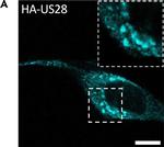 Rat IgG (H+L) Cross-Adsorbed Secondary Antibody in Immunocytochemistry (ICC/IF)