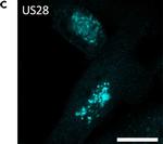 Rabbit IgG (H+L) Cross-Adsorbed Secondary Antibody in Immunocytochemistry (ICC/IF)