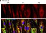 Rabbit IgG (H+L) Highly Cross-Adsorbed Secondary Antibody in Immunocytochemistry (ICC/IF)