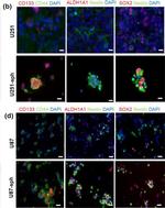 Mouse IgG (H+L) Highly Cross-Adsorbed Secondary Antibody in Immunocytochemistry (ICC/IF)