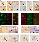 Phospho-Tau (Ser422) Antibody in Immunohistochemistry (Paraffin) (IHC (P))