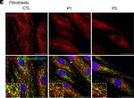 Rabbit IgG (H+L) Highly Cross-Adsorbed Secondary Antibody in Immunocytochemistry (ICC/IF)