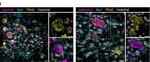 Rabbit IgG (H+L) Highly Cross-Adsorbed Secondary Antibody in Immunohistochemistry (IHC)