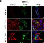 Rabbit IgG (H+L) Highly Cross-Adsorbed Secondary Antibody in Immunocytochemistry (ICC/IF)