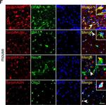 Goat IgG (H+L) Cross-Adsorbed Secondary Antibody in Immunohistochemistry (IHC)