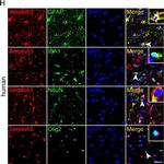 Goat IgG (H+L) Cross-Adsorbed Secondary Antibody in Immunohistochemistry (IHC)