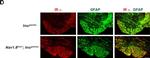 Rabbit IgG (H+L) Cross-Adsorbed Secondary Antibody in Immunohistochemistry (IHC)