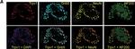 Rabbit IgG (H+L) Highly Cross-Adsorbed Secondary Antibody in Immunohistochemistry (IHC)