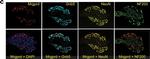 Rabbit IgG (H+L) Highly Cross-Adsorbed Secondary Antibody in Immunohistochemistry (IHC)