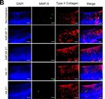 Mouse IgG (H+L) Cross-Adsorbed Secondary Antibody in Immunohistochemistry (IHC)