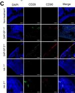 Mouse IgG (H+L) Cross-Adsorbed Secondary Antibody in Immunohistochemistry (IHC)