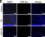 Mouse IgG (H+L) Highly Cross-Adsorbed Secondary Antibody in Immunohistochemistry (IHC)