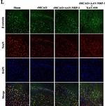 Mouse IgG (H+L) Highly Cross-Adsorbed Secondary Antibody in Immunohistochemistry (IHC)