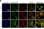 Rabbit IgG (H+L) Cross-Adsorbed Secondary Antibody in Immunocytochemistry (ICC/IF)