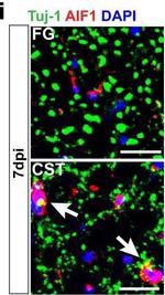 Mouse IgG (H+L) Highly Cross-Adsorbed Secondary Antibody in Immunohistochemistry (IHC)