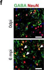 Rabbit IgG (H+L) Highly Cross-Adsorbed Secondary Antibody in Immunohistochemistry (IHC)