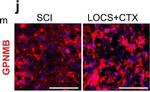 Rabbit IgG (H+L) Highly Cross-Adsorbed Secondary Antibody in Immunohistochemistry (IHC)