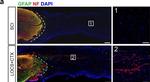 Rabbit IgG (H+L) Highly Cross-Adsorbed Secondary Antibody in Immunohistochemistry (IHC)