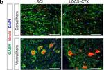 Rabbit IgG (H+L) Highly Cross-Adsorbed Secondary Antibody in Immunohistochemistry (IHC)