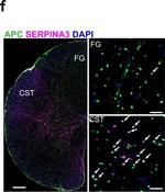 Rabbit IgG (H+L) Highly Cross-Adsorbed Secondary Antibody in Immunohistochemistry (IHC)