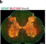 Rabbit IgG (H+L) Highly Cross-Adsorbed Secondary Antibody in Immunohistochemistry (IHC)