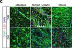 Rabbit IgG (H+L) Highly Cross-Adsorbed Secondary Antibody in Immunohistochemistry (IHC)