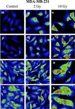 Rabbit IgG (H+L) Cross-Adsorbed Secondary Antibody in Immunocytochemistry (ICC/IF)