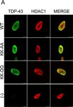 Rabbit IgG (H+L) Cross-Adsorbed Secondary Antibody in Immunocytochemistry (ICC/IF)