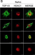 Rabbit IgG (H+L) Cross-Adsorbed Secondary Antibody in Immunocytochemistry (ICC/IF)