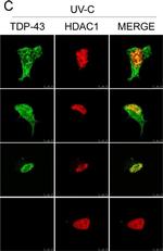 Rabbit IgG (H+L) Cross-Adsorbed Secondary Antibody in Immunocytochemistry (ICC/IF)