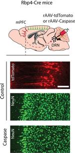 Rabbit IgG (H+L) Highly Cross-Adsorbed Secondary Antibody in Immunohistochemistry (IHC)