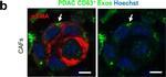 Rabbit IgG (H+L) Highly Cross-Adsorbed Secondary Antibody in Immunocytochemistry (ICC/IF)