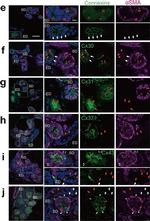 Rabbit IgG (H+L) Highly Cross-Adsorbed Secondary Antibody in Immunohistochemistry (IHC)