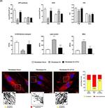 Rabbit IgG (H+L) Cross-Adsorbed Secondary Antibody in Immunohistochemistry (IHC)