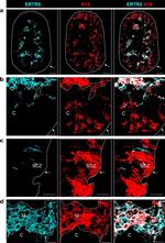 Rabbit IgG (H+L) Highly Cross-Adsorbed Secondary Antibody in Immunohistochemistry (IHC)