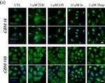 Rabbit IgG (H+L) Highly Cross-Adsorbed Secondary Antibody in Immunocytochemistry (ICC/IF)