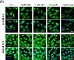 Rabbit IgG (H+L) Highly Cross-Adsorbed Secondary Antibody in Immunocytochemistry (ICC/IF)