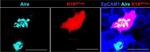 Rabbit IgG (H+L) Highly Cross-Adsorbed Secondary Antibody in Immunohistochemistry (IHC)