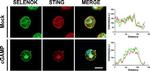 Rabbit IgG (H+L) Highly Cross-Adsorbed Secondary Antibody in Immunocytochemistry (ICC/IF)