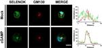 Rabbit IgG (H+L) Highly Cross-Adsorbed Secondary Antibody in Immunocytochemistry (ICC/IF)