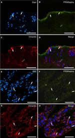 Rabbit IgG (H+L) Highly Cross-Adsorbed Secondary Antibody in Immunocytochemistry (ICC/IF)