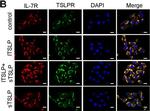 Rabbit IgG (H+L) Secondary Antibody in Immunocytochemistry (ICC/IF)