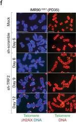 Mouse IgG (H+L) Cross-Adsorbed Secondary Antibody in Immunocytochemistry (ICC/IF)